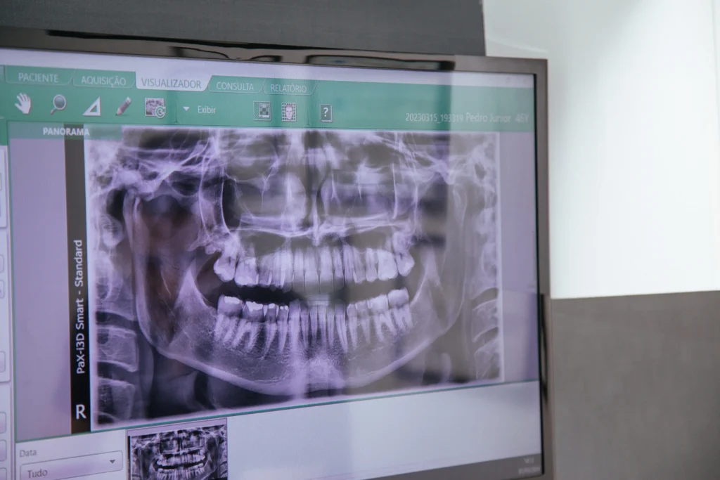 Dentista analisando radiografia digital no consultório da PJ Odontologia